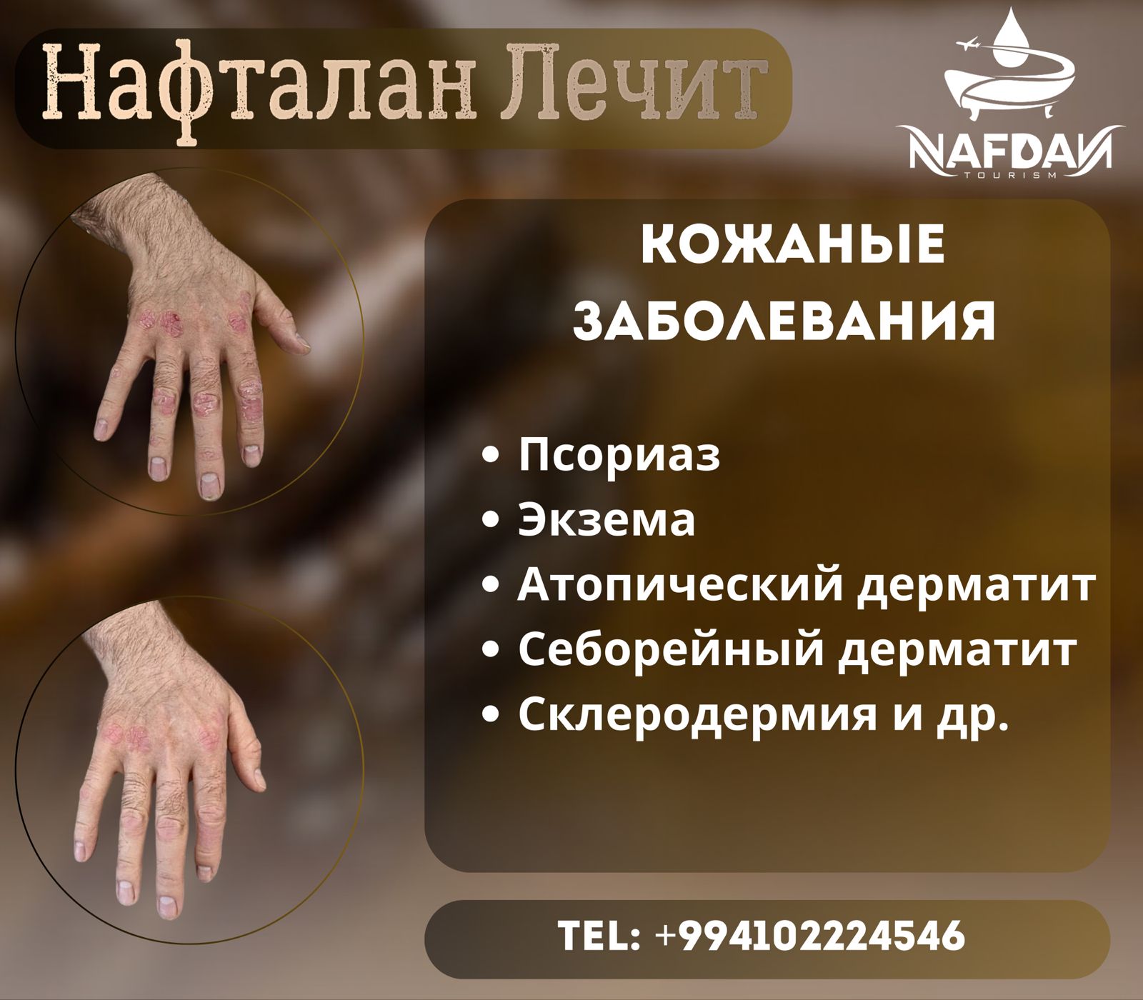 Кожаные заболевания Кожаные заболевания